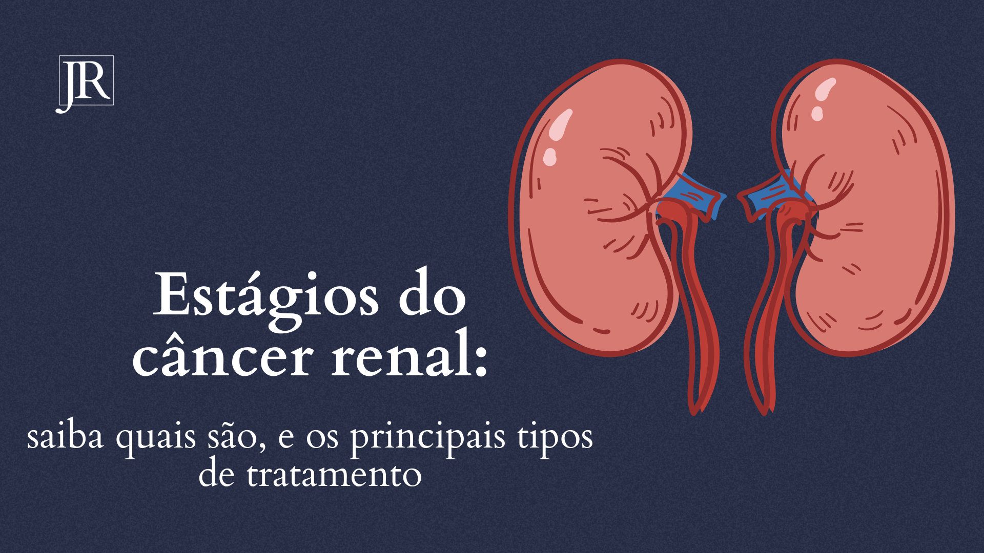 Estágios do câncer renal: saiba quais são, e os principais tipos de tratamento