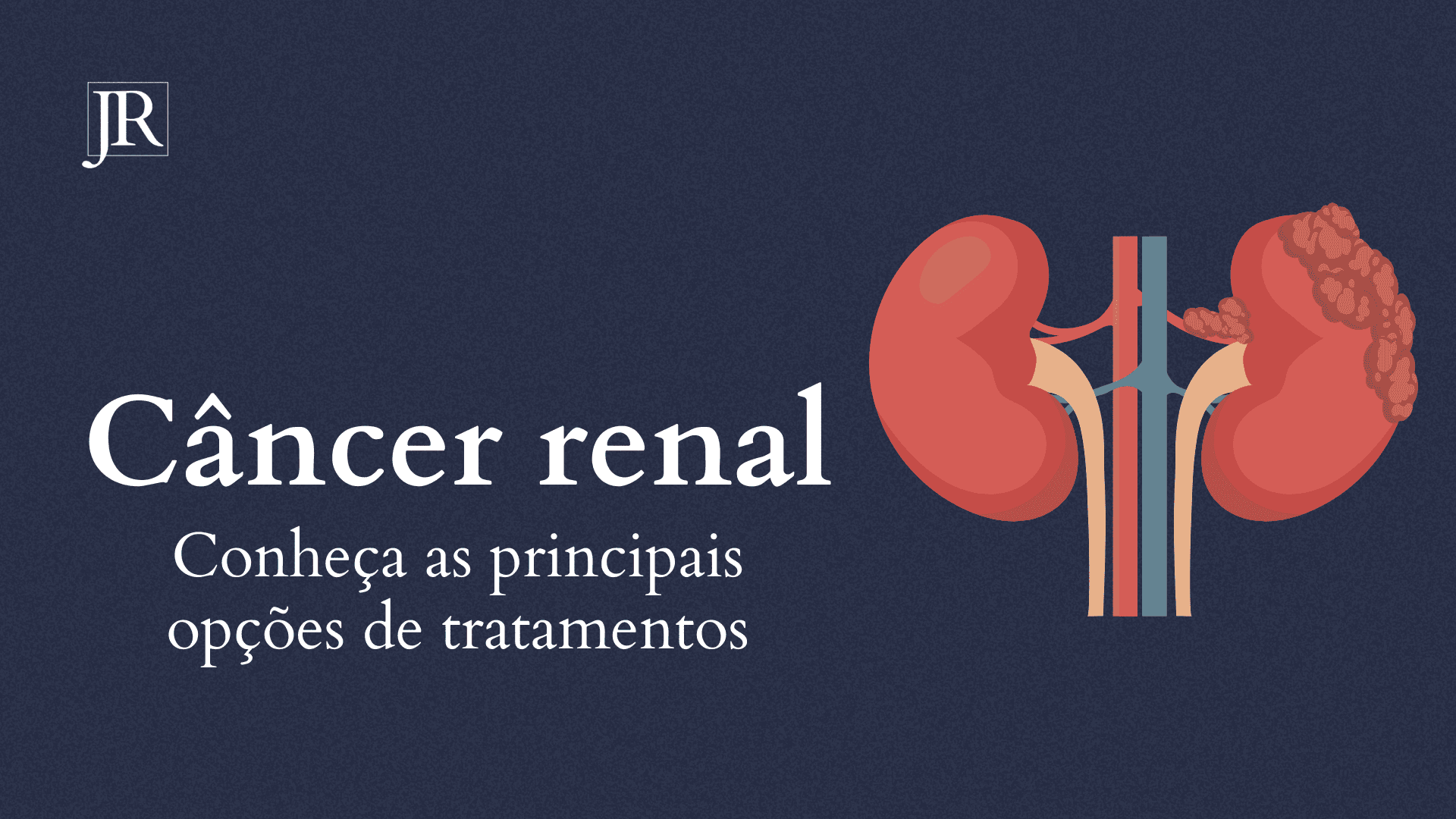 Conheça as principais opções de tratamentos para o câncer renal