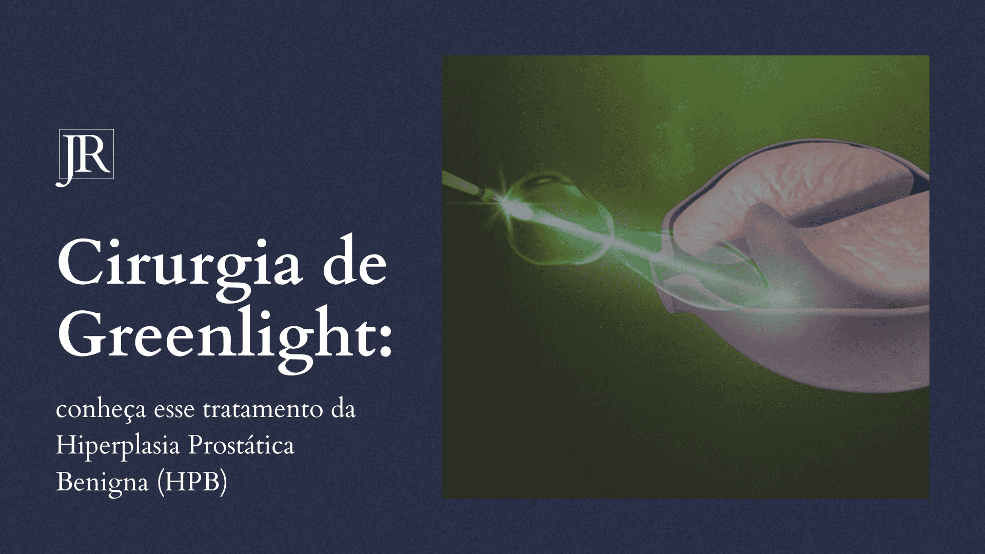 Cirurgia de Greenlight: conheça esse tratamento da Hiperplasia Prostática Benigna (HPB)