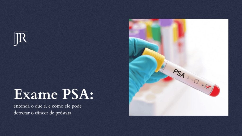 Exame PSA